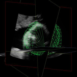 QLAB General Imaging 3D Quantification  ‑ набор инструментов для работы с объемными изображениями